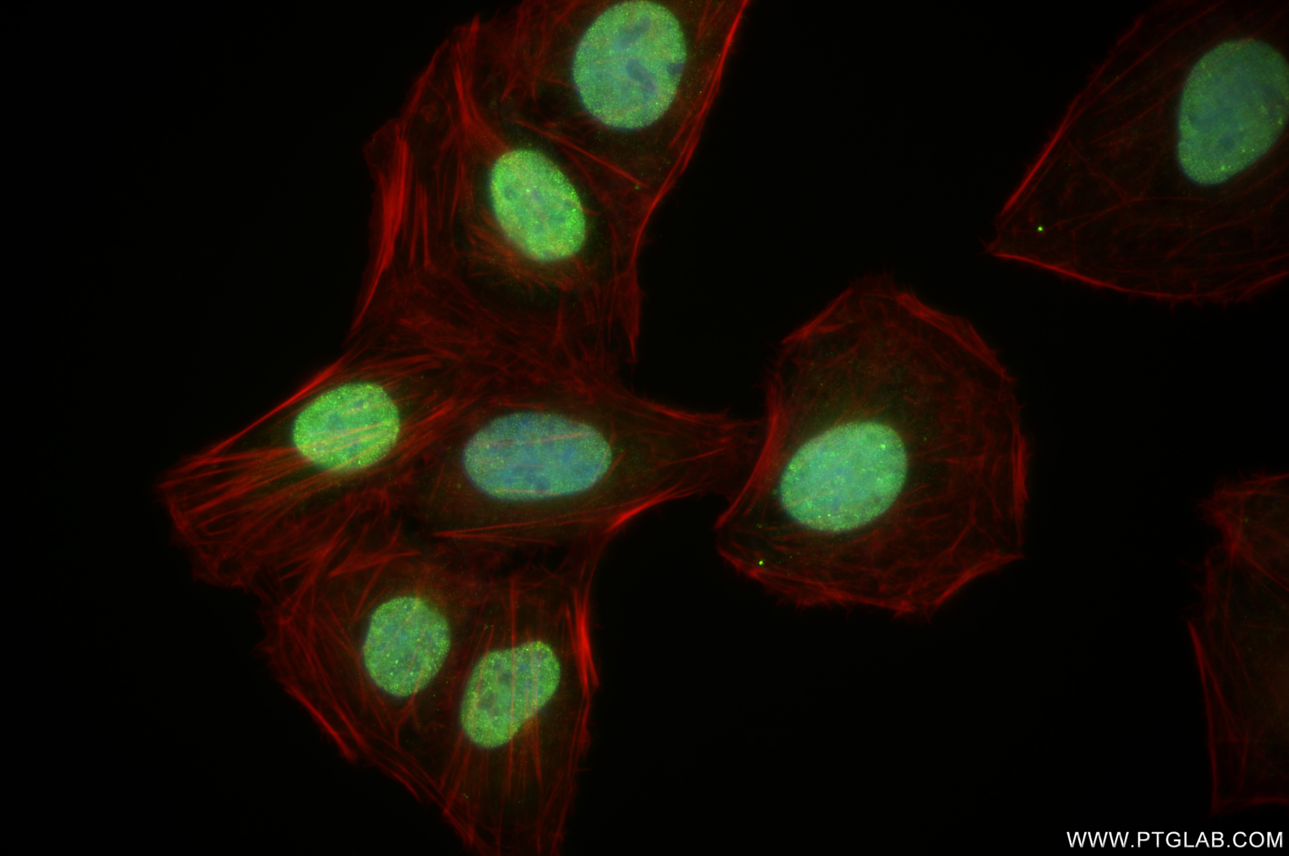 Immunofluorescence (IF) / fluorescent staining of U2OS cells using TNPO1 Recombinant antibody (85007-2-RR)