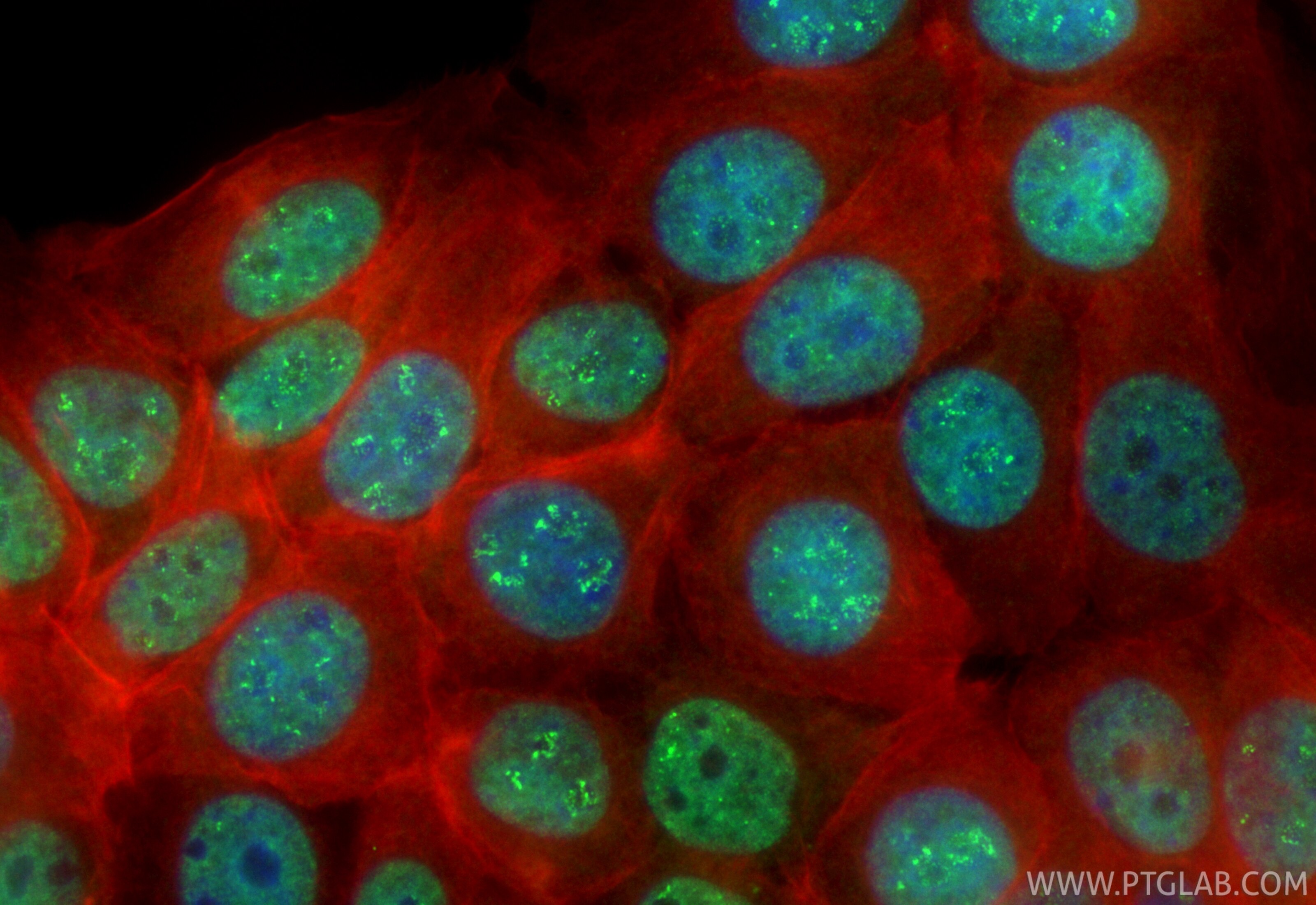 Immunofluorescence (IF) / fluorescent staining of MCF-7 cells using CoraLite® Plus 488-conjugated TNPO1 Recombinant an (CL488-85007-2)
