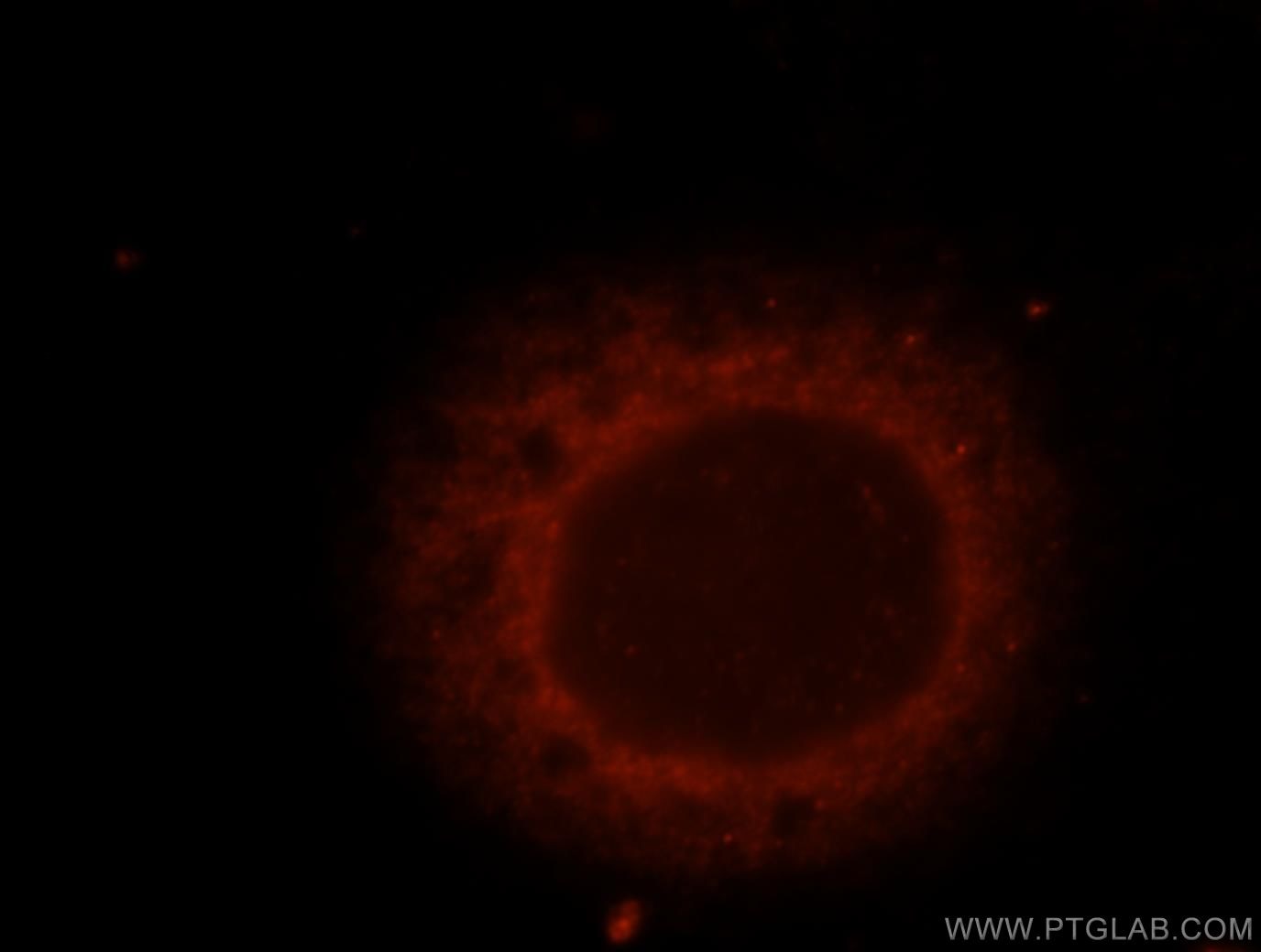Immunofluorescence (IF) / fluorescent staining of MCF-7 cells using TNPO2 Polyclonal antibody (17831-1-AP)