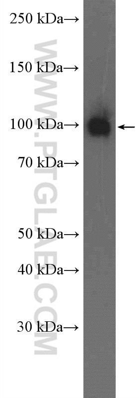 WB analysis of fetal human brain using 17831-1-AP