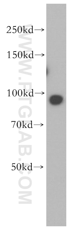 Western Blot (WB) analysis of HeLa cells using TNPO2 Polyclonal antibody (17831-1-AP)