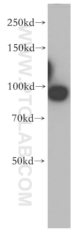 Western Blot (WB) analysis of Jurkat cells using TNPO2 Polyclonal antibody (17831-1-AP)