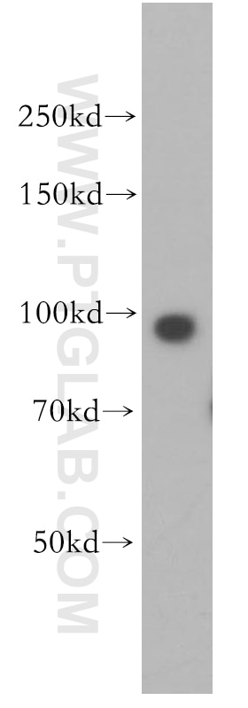 Western Blot (WB) analysis of HEK-293 cells using TNPO2 Polyclonal antibody (17831-1-AP)