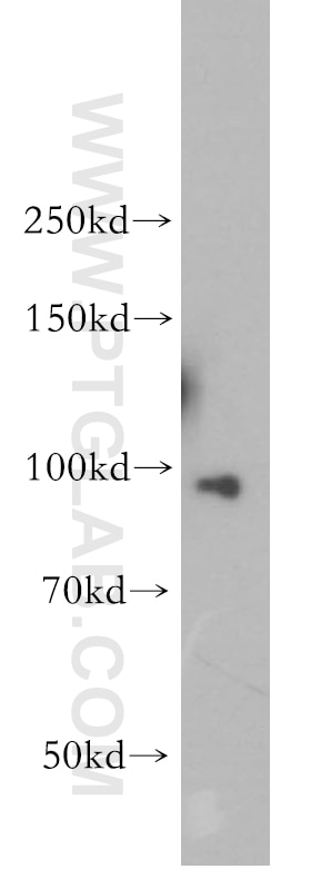 Western Blot (WB) analysis of K-562 cells using TNPO2 Polyclonal antibody (17831-1-AP)