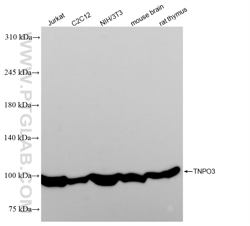 Western Blot (WB) analysis of various lysates using TNPO3 Recombinant antibody (83704-2-RR)