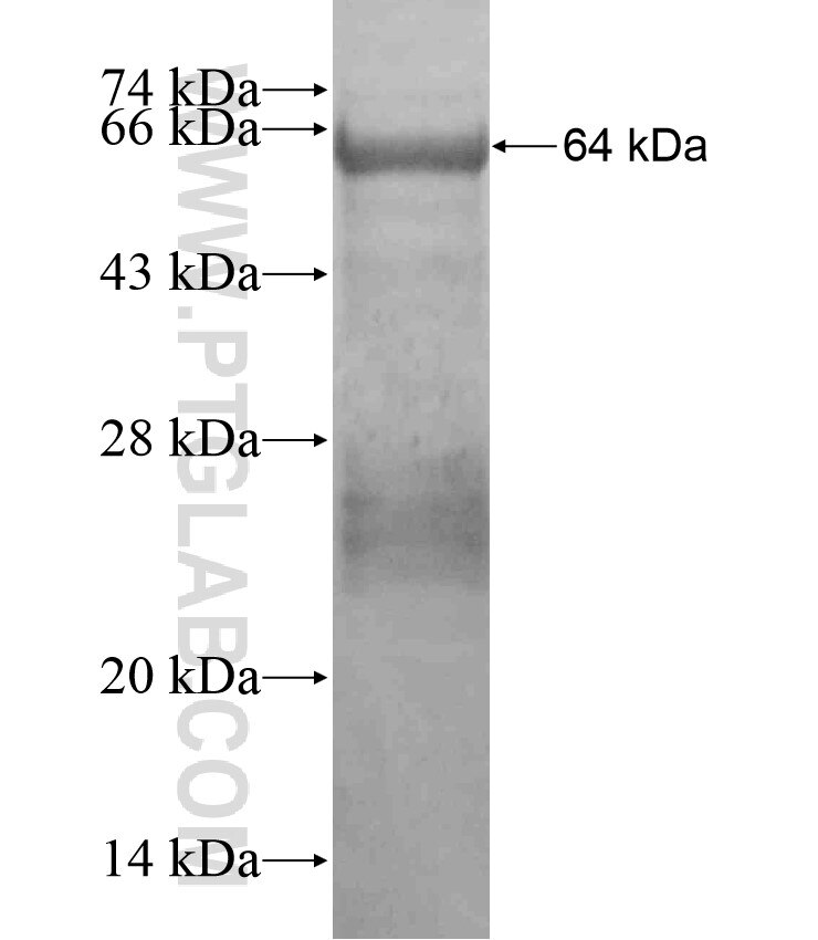 TNR fusion protein Ag18194 SDS-PAGE