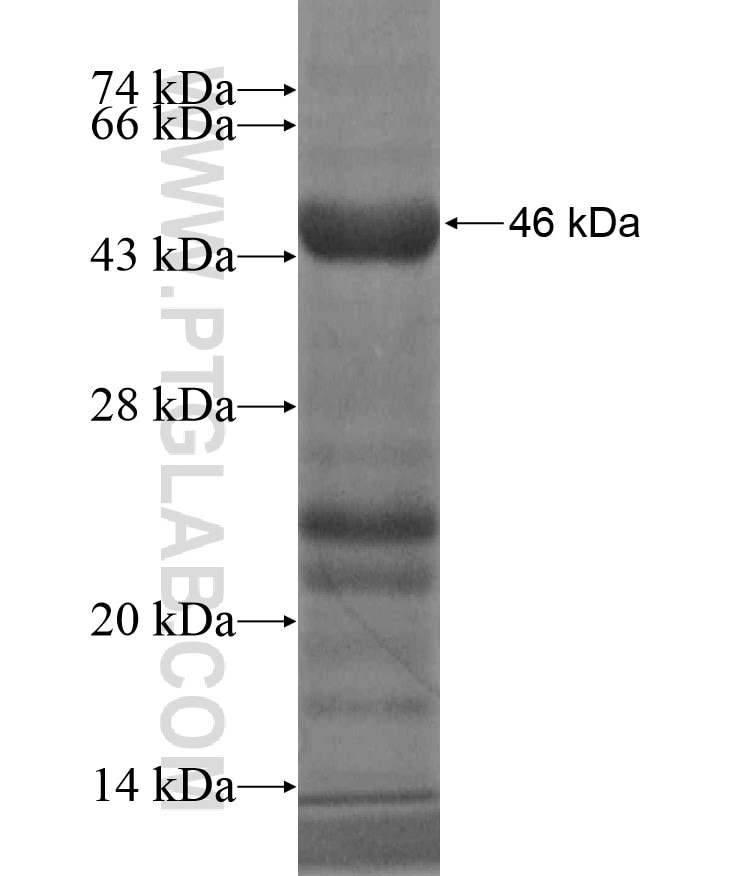 TNR fusion protein Ag18504 SDS-PAGE