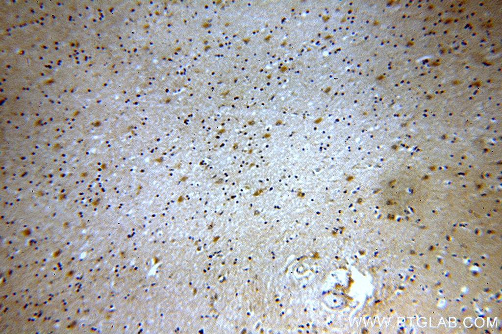 Immunohistochemistry (IHC) staining of human brain tissue using Tenascin-R Polyclonal antibody (19730-1-AP)