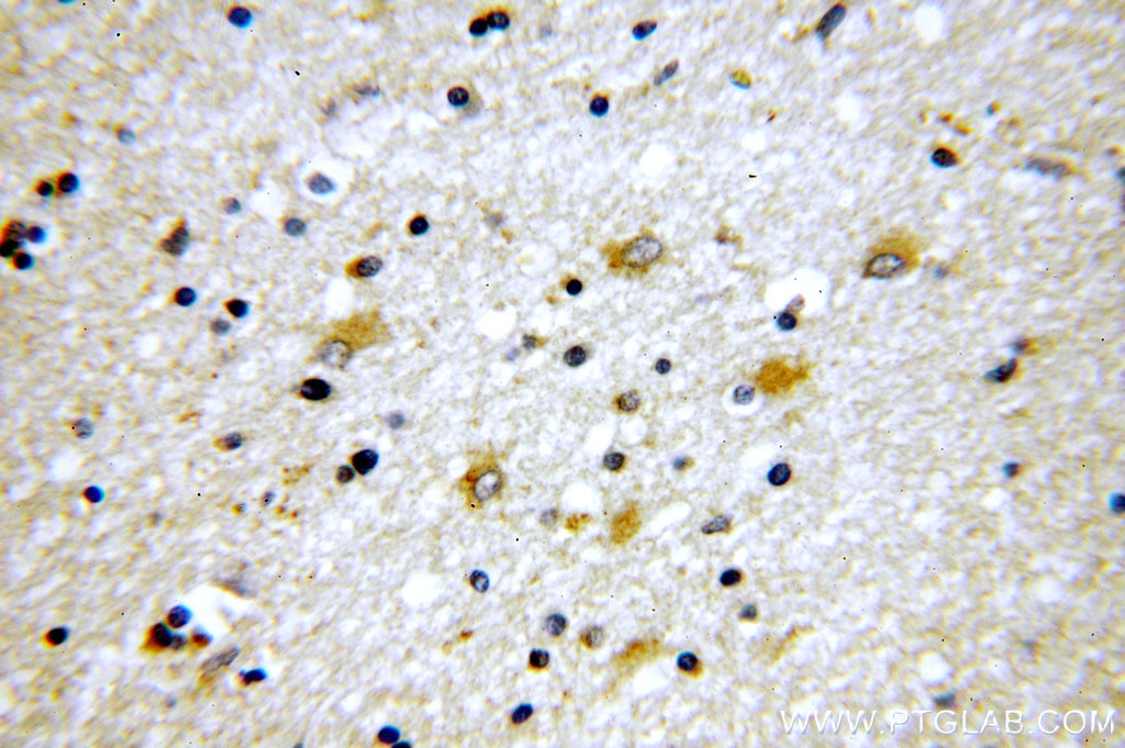IHC staining of human brain using 19730-1-AP