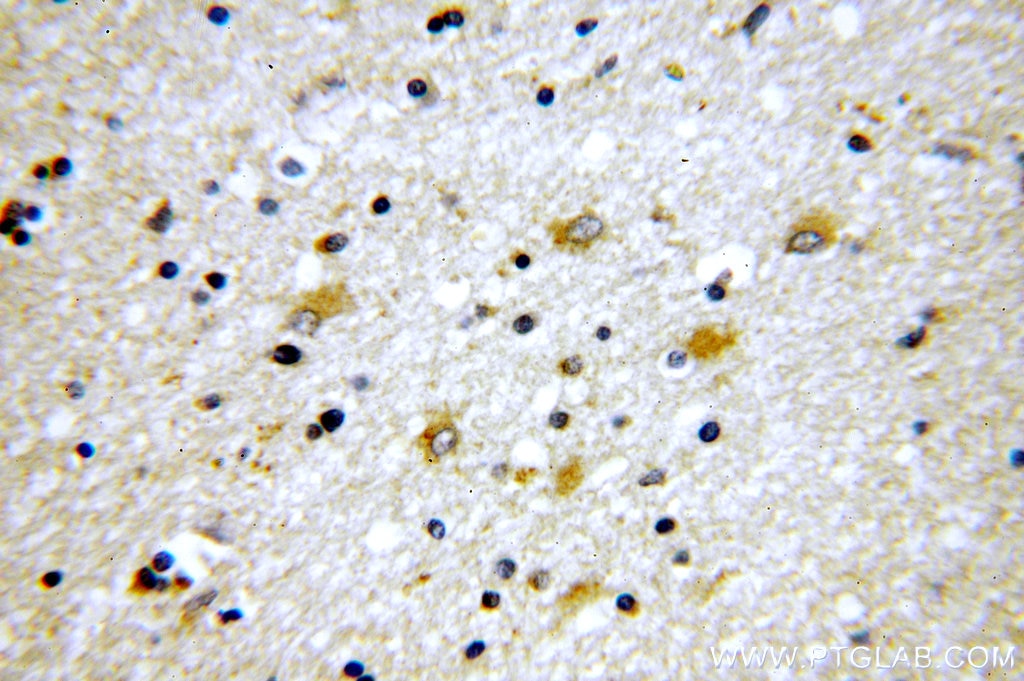 Immunohistochemistry (IHC) staining of human brain tissue using Tenascin-R Polyclonal antibody (19730-1-AP)