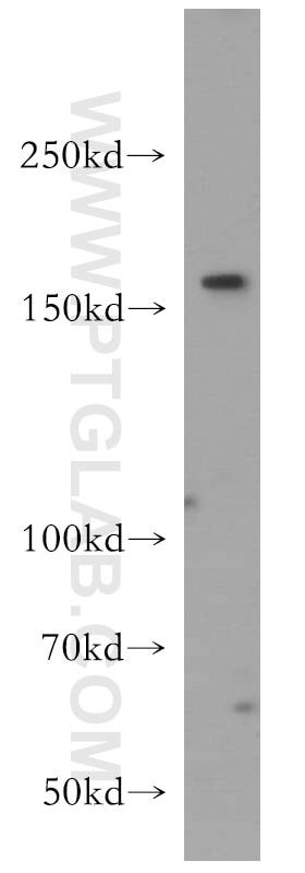 Western Blot (WB) analysis of SH-SY5Y cells using Tenascin-R Polyclonal antibody (19730-1-AP)