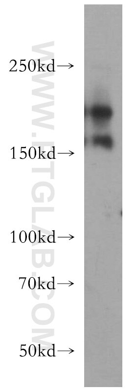 Western Blot (WB) analysis of human brain tissue using Tenascin-R Polyclonal antibody (19730-1-AP)