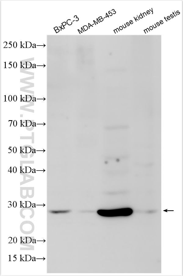 Western Blot (WB) analysis of various lysates using TNRC18 Polyclonal antibody (32165-1-AP)