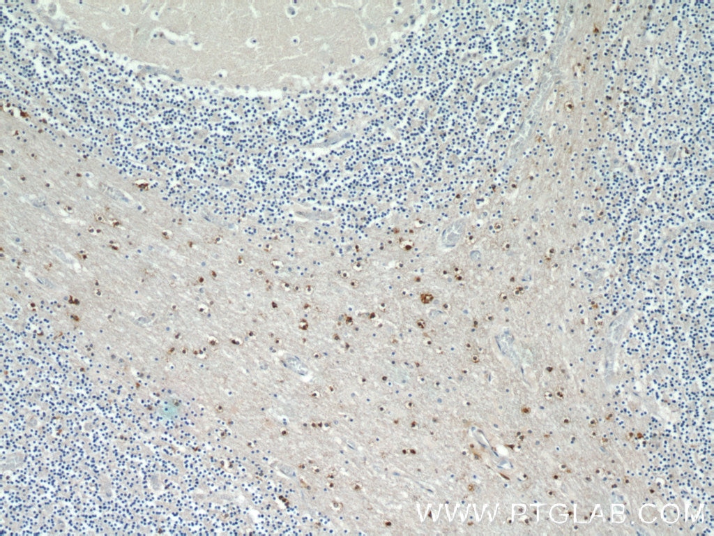Immunohistochemistry (IHC) staining of human cerebellum tissue using TNRC4 Polyclonal antibody (25353-1-AP)