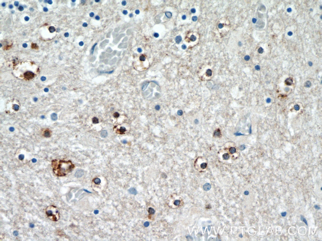 Immunohistochemistry (IHC) staining of human cerebellum tissue using TNRC4 Polyclonal antibody (25353-1-AP)