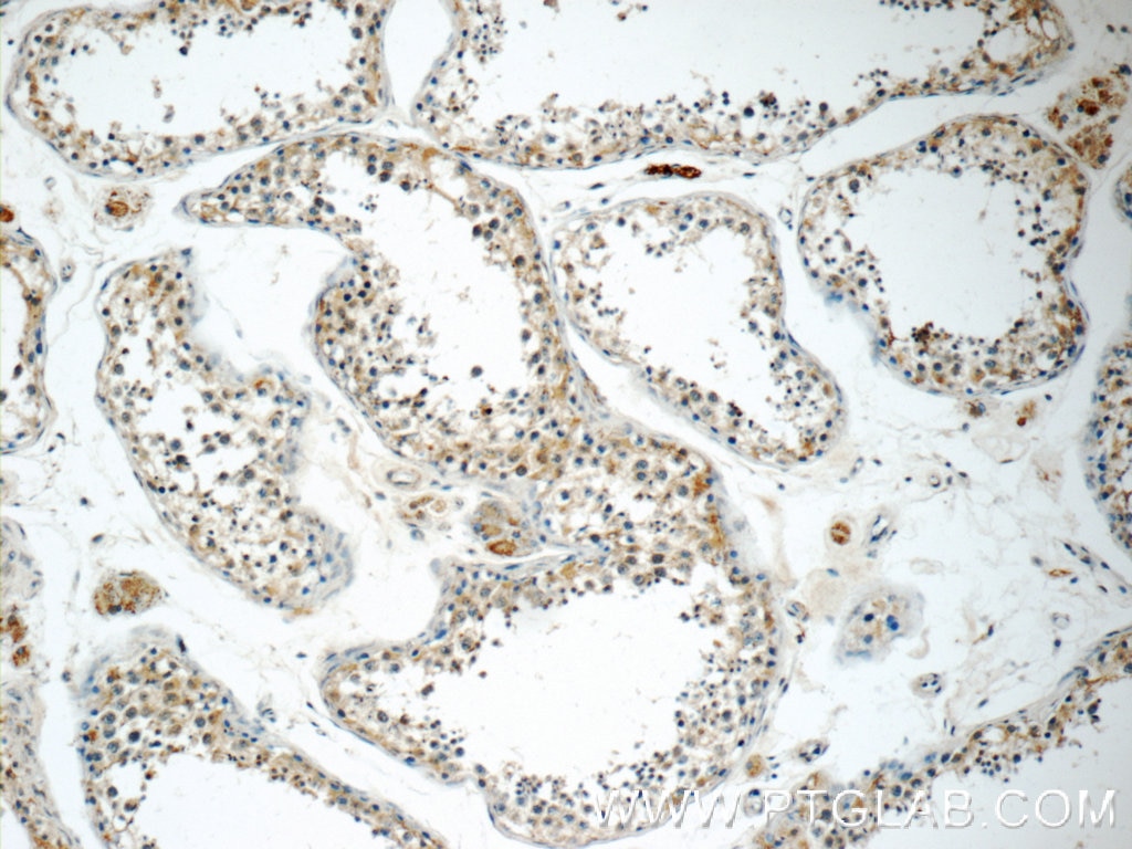 Immunohistochemistry (IHC) staining of human testis tissue using TNRC4 Polyclonal antibody (25353-1-AP)
