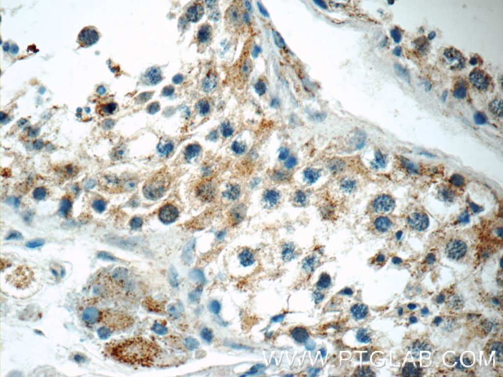 Immunohistochemistry (IHC) staining of human testis tissue using TNRC4 Polyclonal antibody (25353-1-AP)