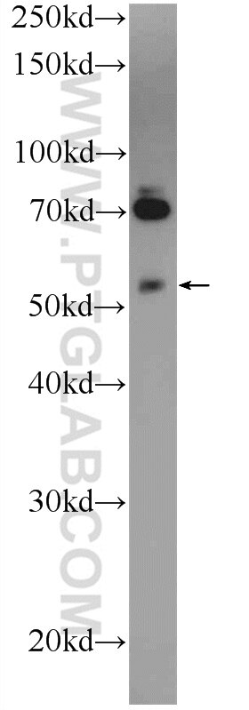 Western Blot (WB) analysis of mouse lung tissue using TNRC4 Polyclonal antibody (25353-1-AP)