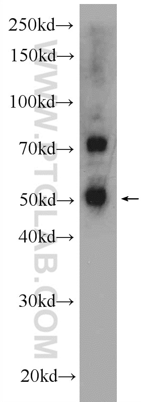 Western Blot (WB) analysis of mouse spleen tissue using TNRC4 Polyclonal antibody (25353-1-AP)