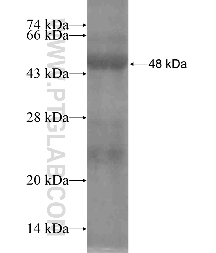 TNRC4 fusion protein Ag18305 SDS-PAGE