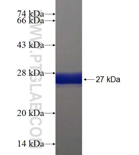 TNRC4 fusion protein Ag18601 SDS-PAGE
