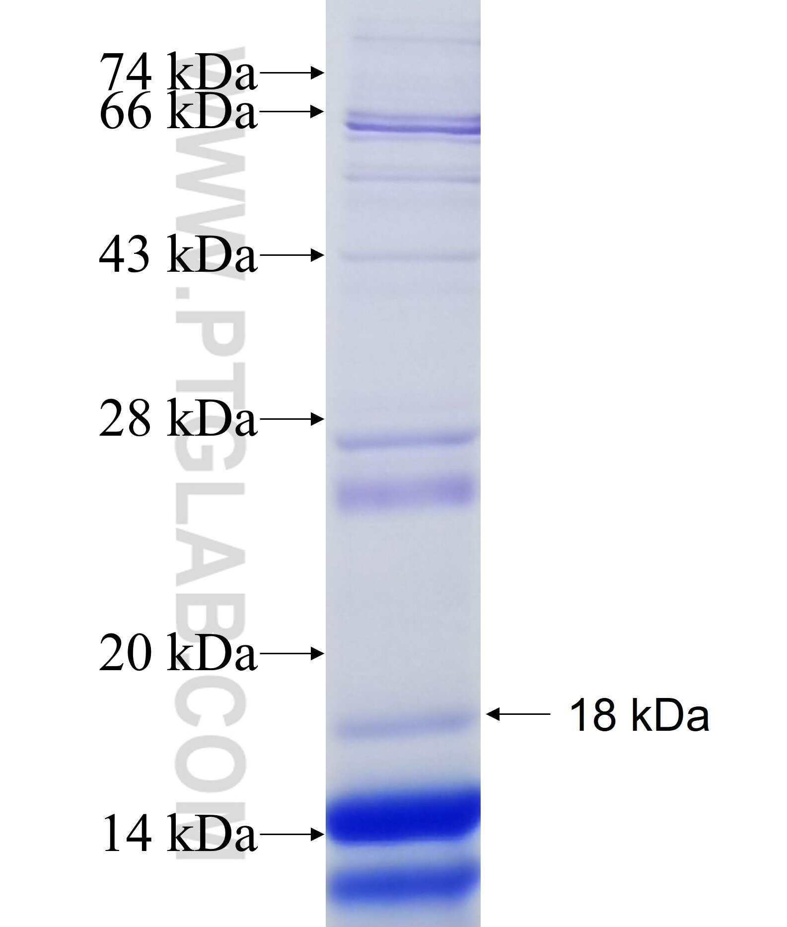 TNRC6A fusion protein Ag34199 SDS-PAGE