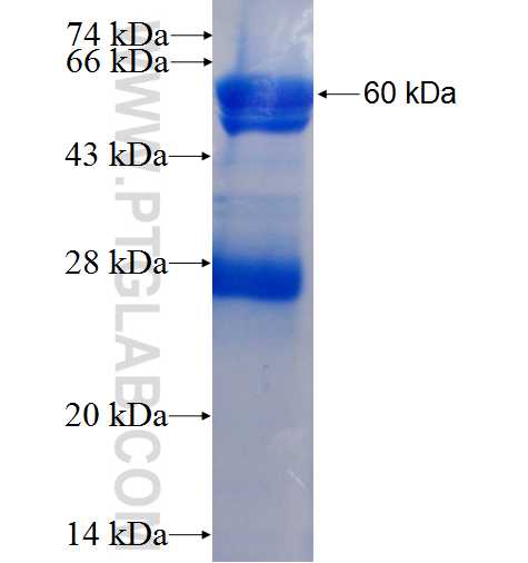 TNRC6A fusion protein Ag3794 SDS-PAGE