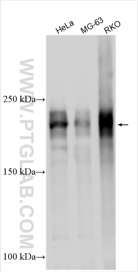 Western Blot (WB) analysis of various lysates using TNRC6B Polyclonal antibody (17497-1-AP)