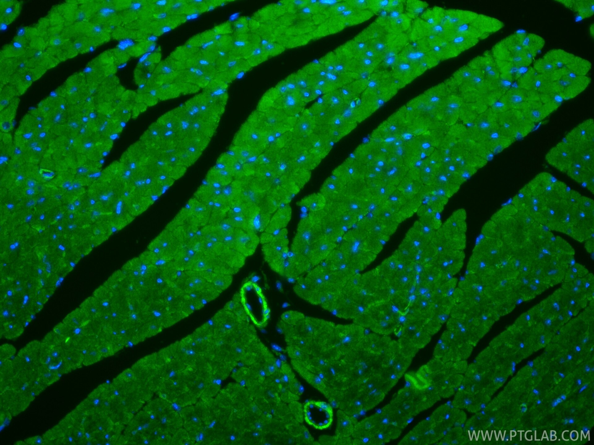 Immunofluorescence (IF) / fluorescent staining of mouse heart tissue using TNS1 Polyclonal antibody (20054-1-AP)