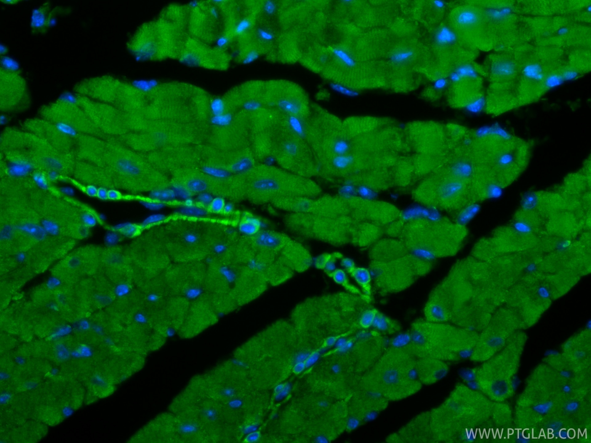Immunofluorescence (IF) / fluorescent staining of mouse heart tissue using TNS1 Polyclonal antibody (20054-1-AP)