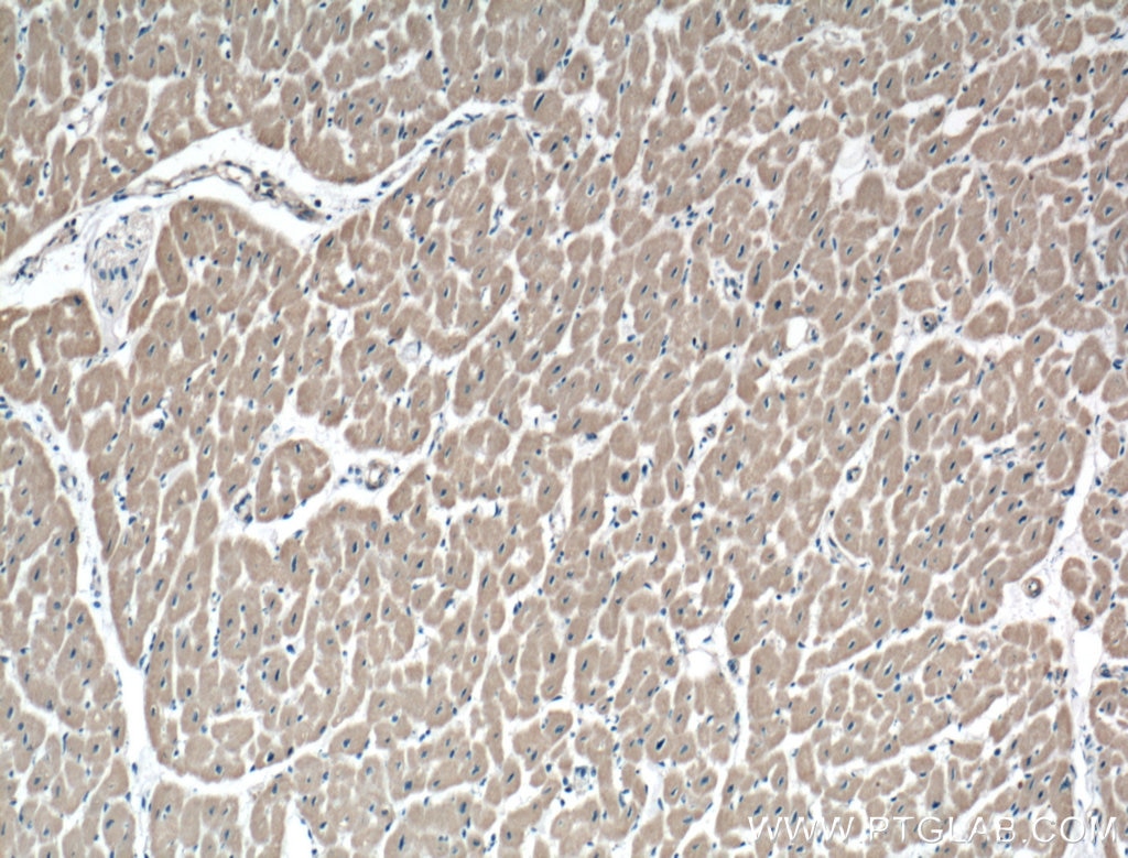 Immunohistochemistry (IHC) staining of human heart tissue using TNS1 Polyclonal antibody (20054-1-AP)