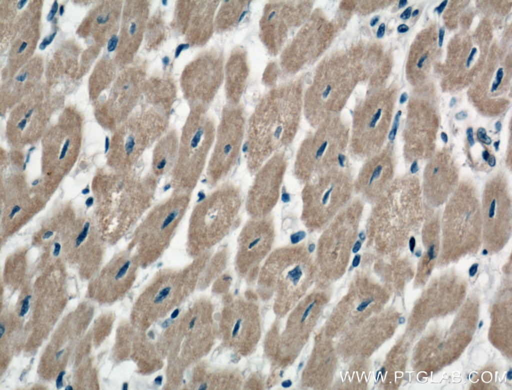 IHC staining of human heart using 20054-1-AP
