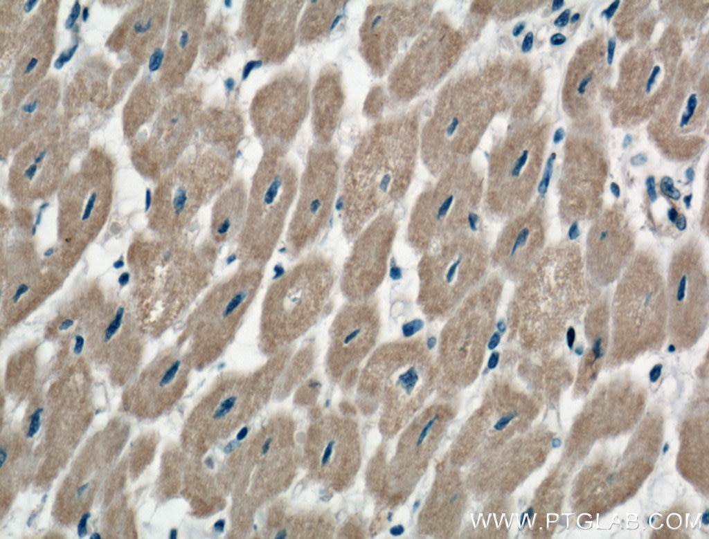 Immunohistochemistry (IHC) staining of human heart tissue using TNS1 Polyclonal antibody (20054-1-AP)