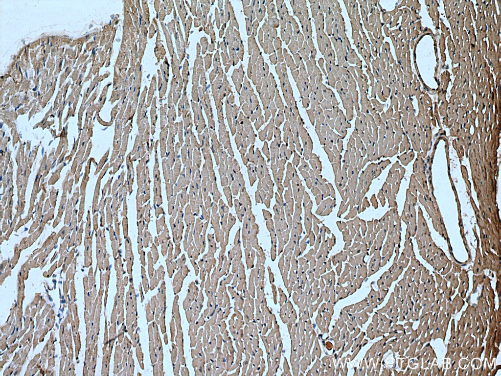 Immunohistochemistry (IHC) staining of mouse heart tissue using TNS1 Polyclonal antibody (20054-1-AP)
