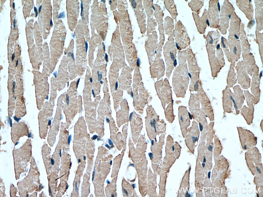 Immunohistochemistry (IHC) staining of mouse heart tissue using TNS1 Polyclonal antibody (20054-1-AP)