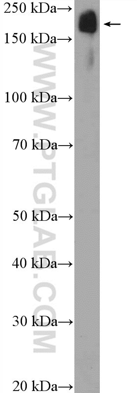 Western Blot (WB) analysis of mouse heart tissue using TNS1 Polyclonal antibody (20054-1-AP)