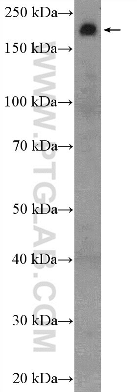 Western Blot (WB) analysis of mouse heart tissue using TNS1 Polyclonal antibody (20054-1-AP)