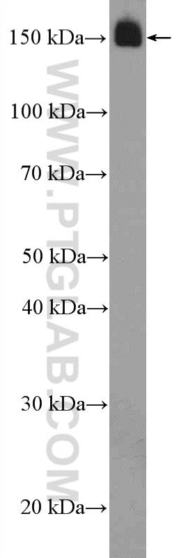 Western Blot (WB) analysis of mouse heart tissue using TNS1 Polyclonal antibody (20054-1-AP)