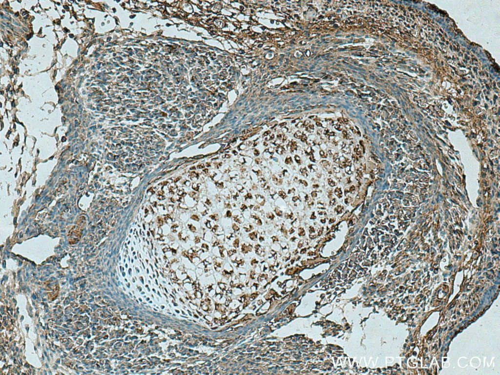 Immunohistochemistry (IHC) staining of mouse embryo tissue using TNS3 Polyclonal antibody (20053-1-AP)