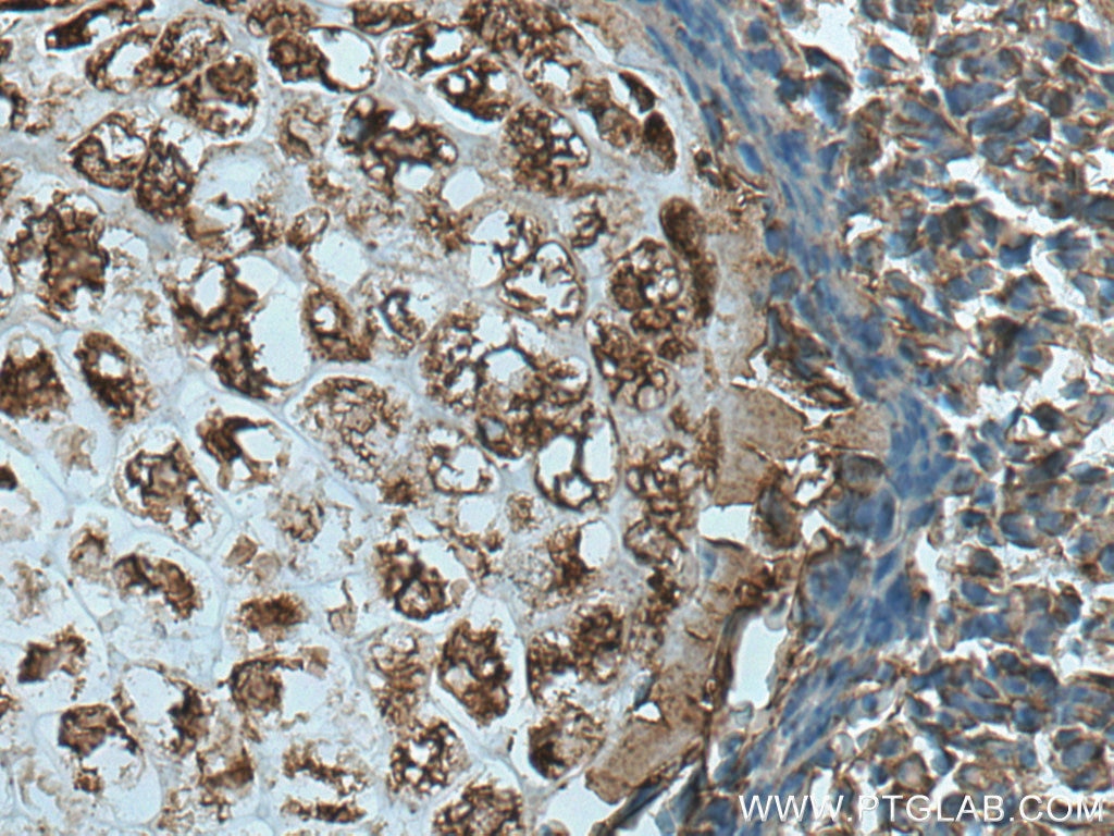 Immunohistochemistry (IHC) staining of mouse embryo tissue using TNS3 Polyclonal antibody (20053-1-AP)