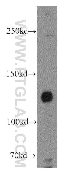 Western Blot (WB) analysis of mouse kidney tissue using TNS3 Polyclonal antibody (20053-1-AP)