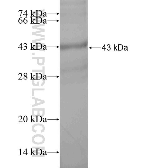 TNS3 fusion protein Ag19563 SDS-PAGE
