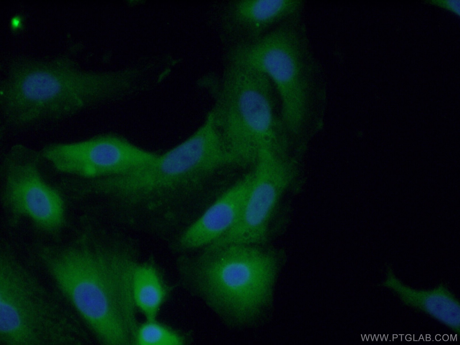 Immunofluorescence (IF) / fluorescent staining of A549 cells using TNS4 Polyclonal antibody (11580-1-AP)