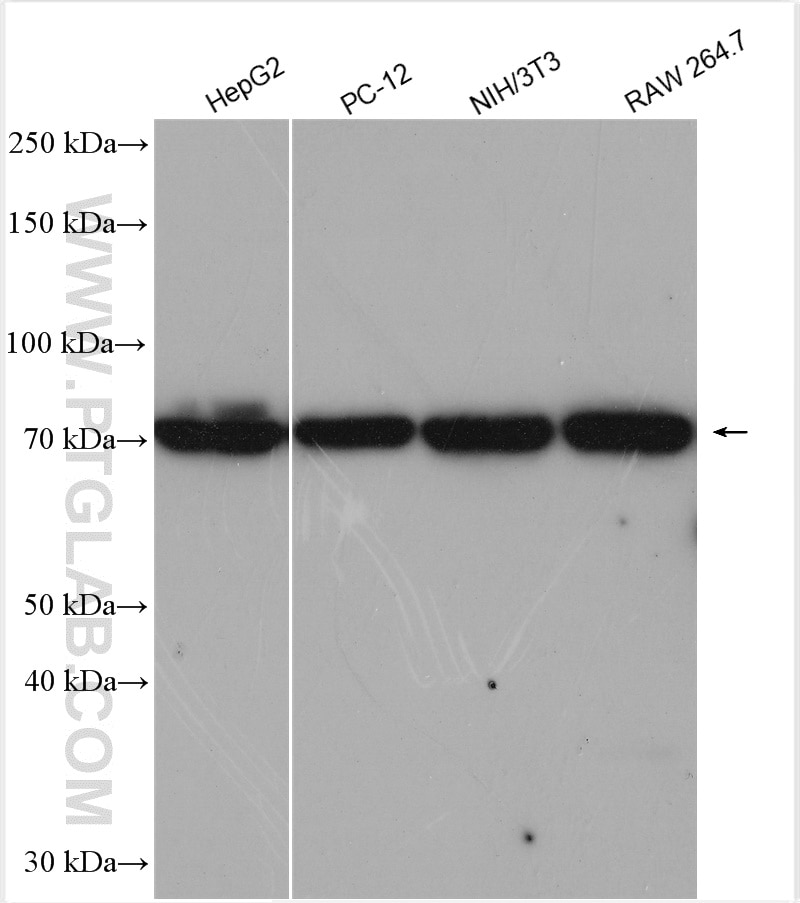 Western Blot (WB) analysis of various lysates using TNS4 Polyclonal antibody (11580-1-AP)