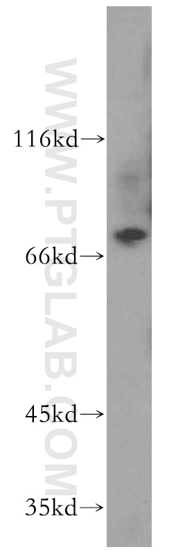Western Blot (WB) analysis of human placenta tissue using TNS4 Polyclonal antibody (11580-1-AP)