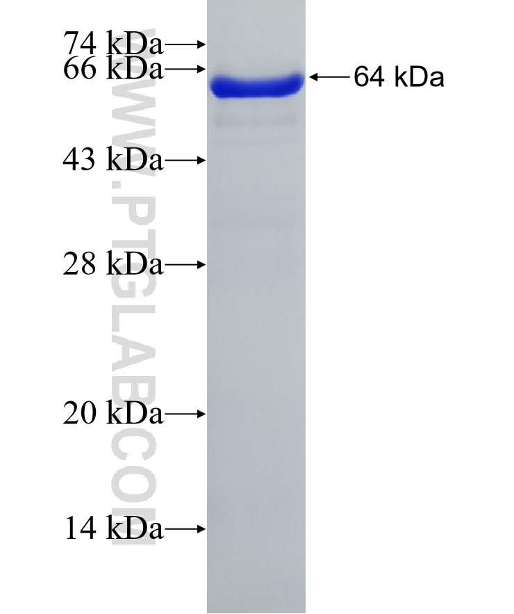 TNS4 fusion protein Ag2169 SDS-PAGE