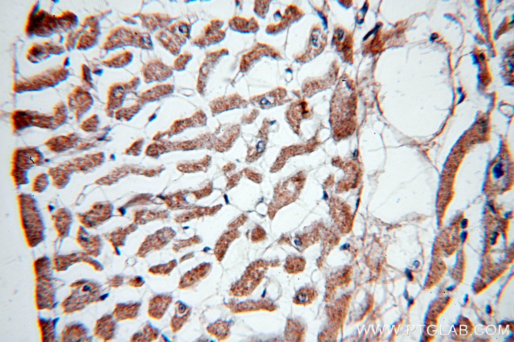 Immunohistochemistry (IHC) staining of human heart tissue using Tenascin-X Polyclonal antibody (13595-1-AP)