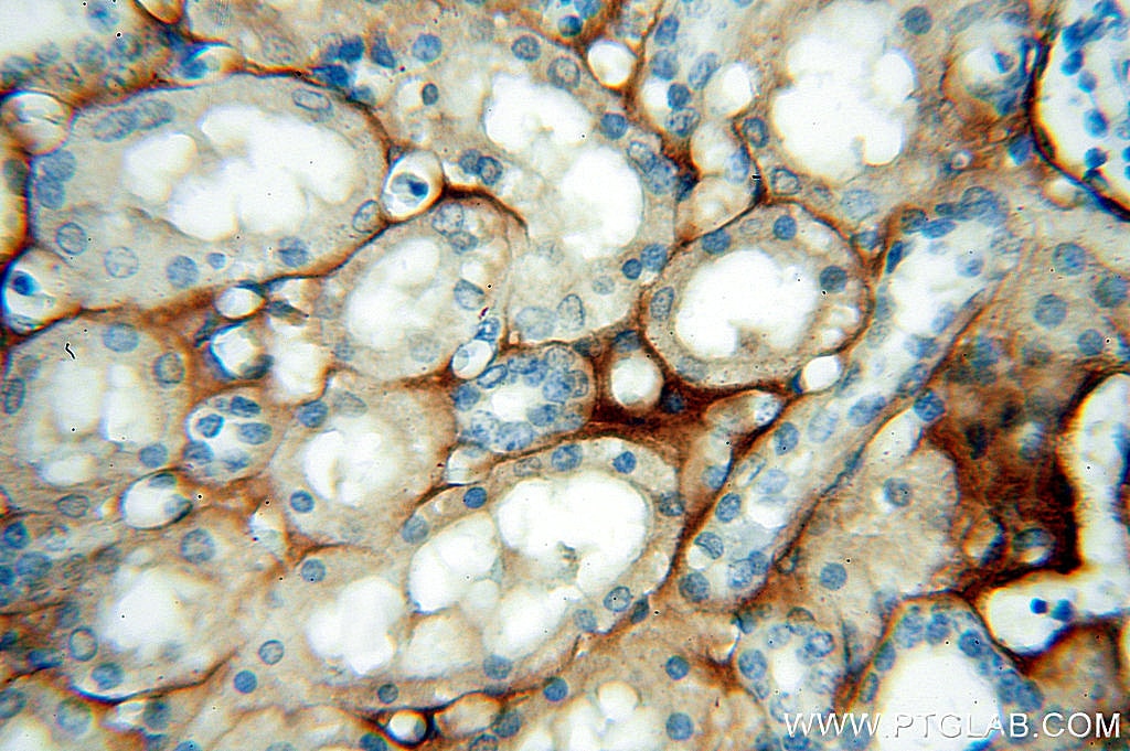 Immunohistochemistry (IHC) staining of human kidney tissue using Tenascin-X Polyclonal antibody (13595-1-AP)