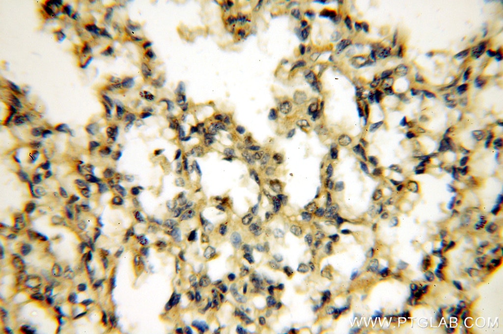 Immunohistochemistry (IHC) staining of human lung tissue using Tenascin-X Polyclonal antibody (13595-1-AP)