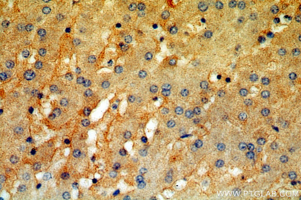 Immunohistochemistry (IHC) staining of human liver tissue using Tenascin-X Polyclonal antibody (13595-1-AP)